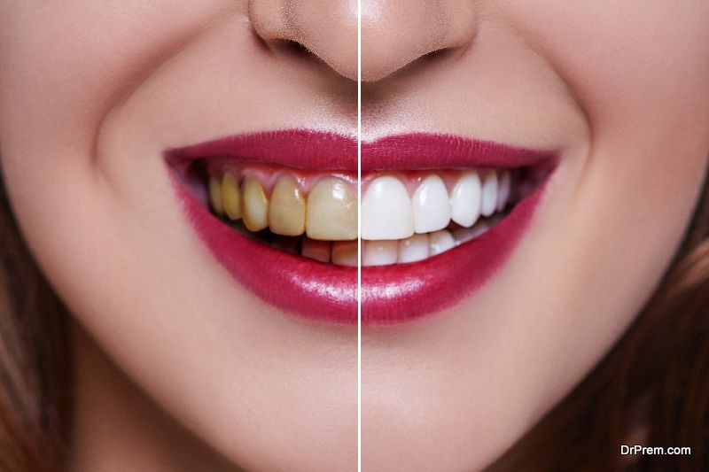 Natural Tips For A Wonderful Smile
