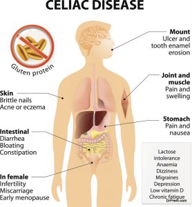 celiac