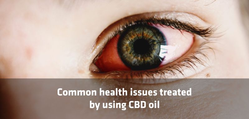 Common Health Issues Treated Using CBD Oil